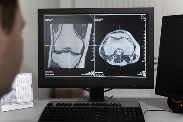 check-up de saúde, exames de imagem para homens e mulheres, densitometria óssea