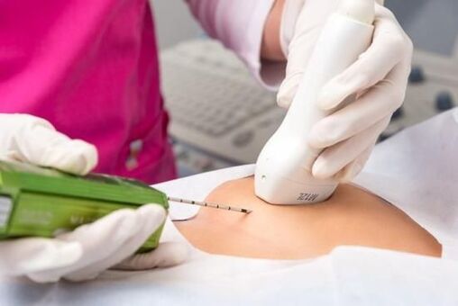 Cuidados após os exames de imagem da mama