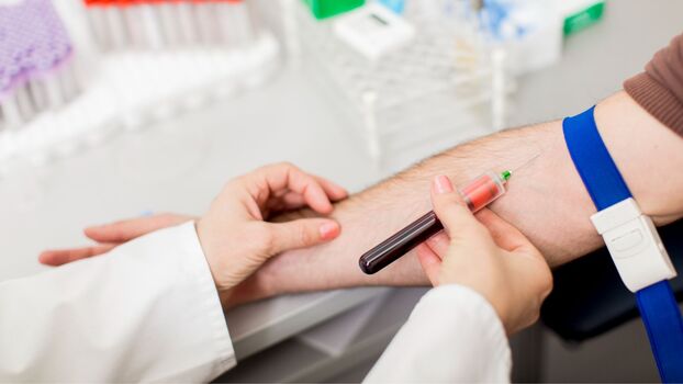 Exame de fígado alterado