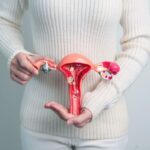 mioma uterino