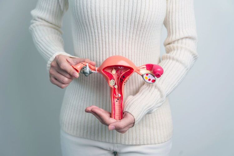 mioma uterino